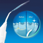 Power Floss - Air Powered Dental Water Jet - Image 2